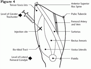 anteriolateral_thigh