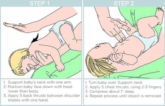 baby-choking